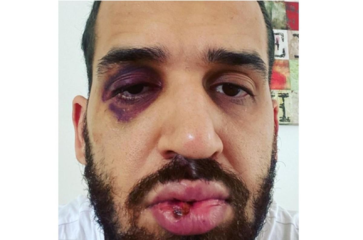 Médico é agredido por Familiar