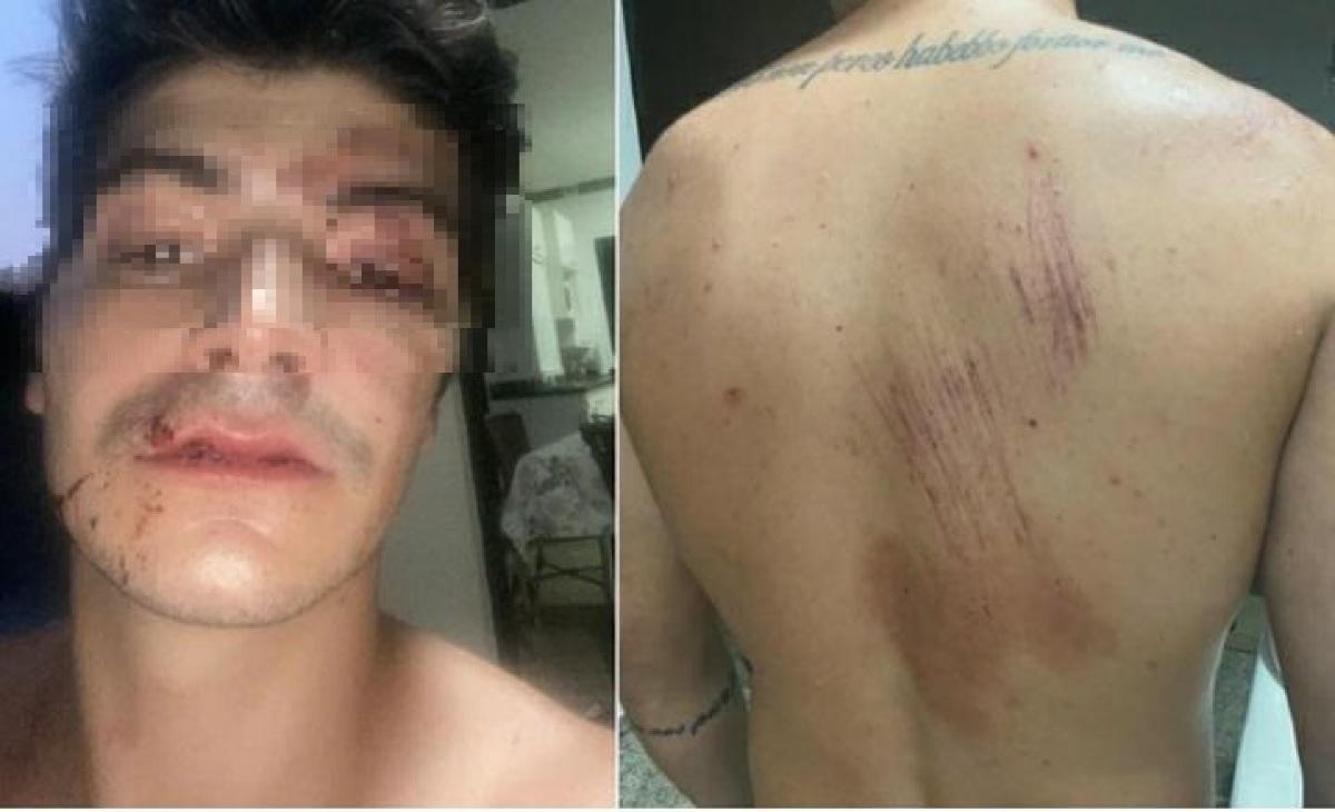 VGN; agressão; espancamento; acusão; estudante; medicina; policiais militares; Cuiabá