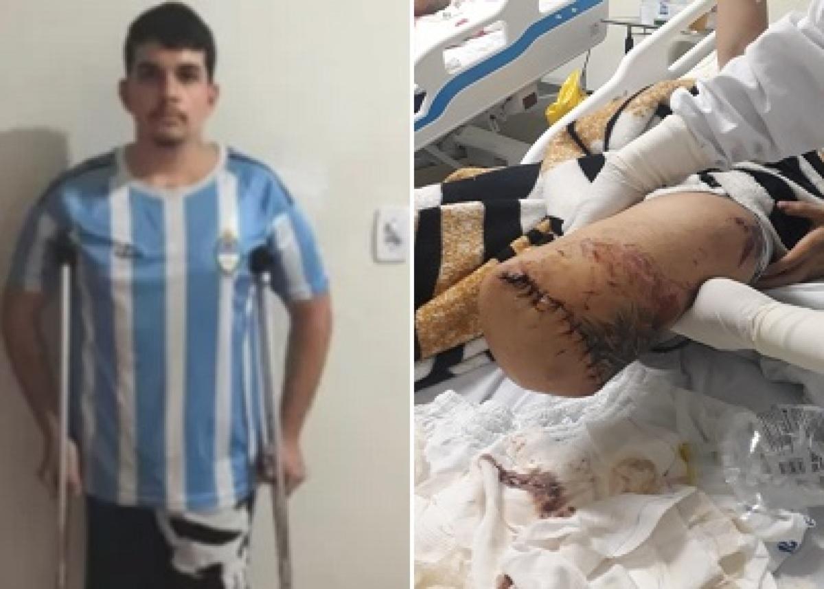 VGN; acidente; jovem; Várzea Grande; perna amputada