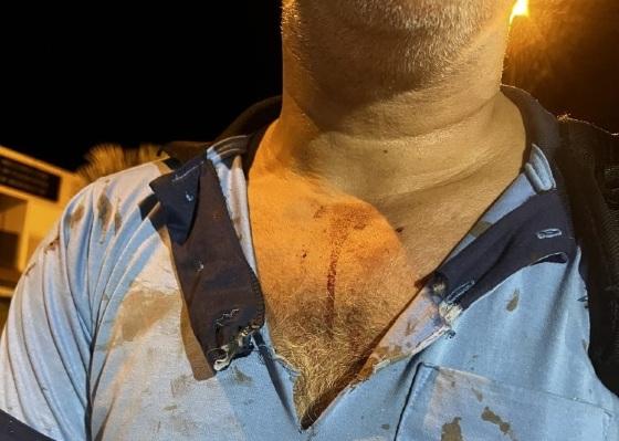 Jovem agride motorista da União Transporte.