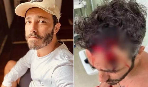 Ator Thiago Rodrigues caiu sozinho e não foi espancado ou roubado, conclui investigação