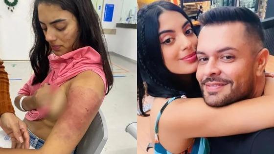 Isabella Lacerda, de 20 anos, foi ameaçada com arma, torturada e espancada por Thiago Brandão Abreu, 40, por cerca de três horas