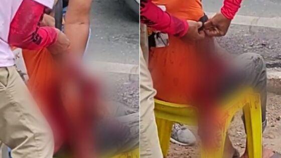 Homem tem braço dilacerado após cair e ônibus passar por cima em Cuiabá.