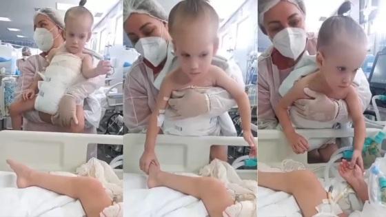 Registro foi compartilhado pelo médico Zacharias Calil, que acompanha as gêmeas desde o procedimento cirúrgico realizado no HECAD.