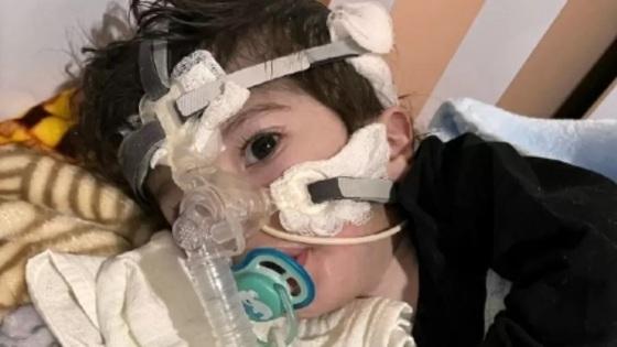 Vinícius Samsel, de 3 anos, morreu em decorrência da AME (Atrofia Muscular Espinhal) 1 dia após a União depositar o valor do medicamento, considerado um dos mais caros do mundo.