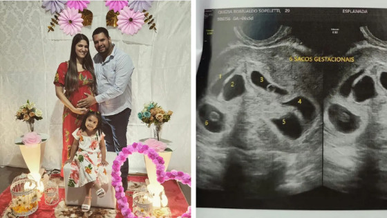 Mãe descobre que está grávida de sêxtuplos: 'Fui na consulta só para ver 1 bebê e descobri 6'.
