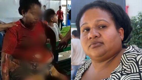 Dona de espetinho atropelada em praça diz que nasceu de novo, mas que família perdeu "ganha pão" 