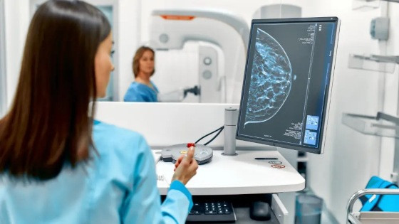Pesquisadora da UFMG desenvolve Inteligência Artificial que ajuda no diagnóstico do câncer de mama