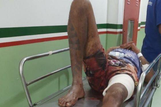 Bandido envolvido em assalto é baleado por PMs durante perseguição em VG