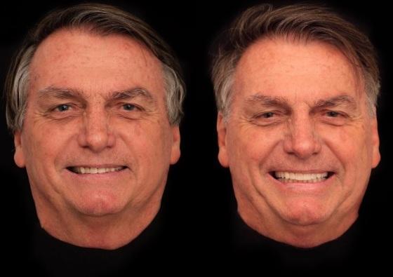 Dentista divulga na rede social harmonização orofacial de Bolsonaro