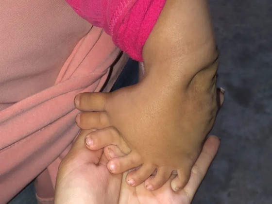 Priscila pede ajuda para conseguir um tratamento digno a sua filha