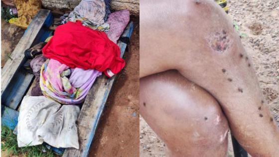 Homem é preso por maus-tratos contra a mãe; vítima é resgatada coberta de fezes