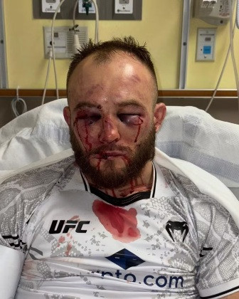 Lutador; MMA; Estragos;