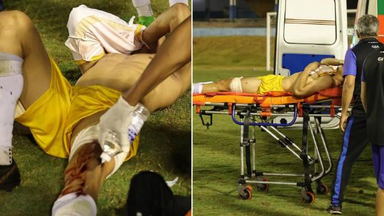 PM atira em goleiro com bala de borracha durante confusão em partida de futebol.