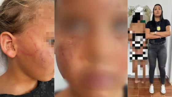 Mulher é presa em flagrante por agredir e morder rosto da filha de 4 anos 