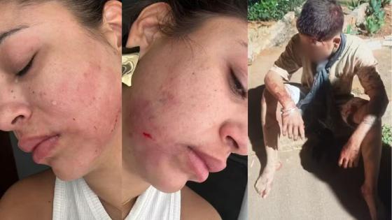 Empresária denuncia marido por agressão e por esfaquear o filho para atraí-la e tentar matá-la