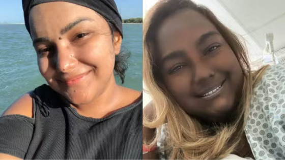 "Mudei de coloração muito rápido. Questão de meses", diz jovem que enfrenta efeitos de um tumor raro