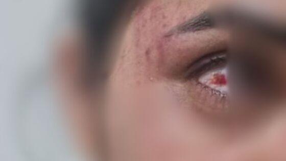 Biomédica diz que ex-companheiro era muito ciumento e após agressões solicitou medida protetiva 