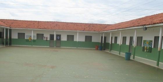 Menina que sofreu queimadura de 2º grau no rosto, supostamente provocada por uma professora durante uma atividade