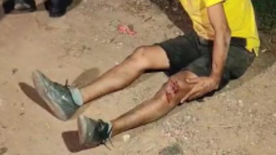 Venezuelano é agredido com pedradas durante comemoração do Dia das Mães em Cuiabá