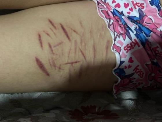 Grupo que incitava suicídio e violência psicológica é alvo de operação nacional