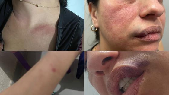 Farmacêutica denuncia servidor público por agressão em Cuiabá.
