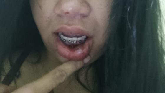 Mulher é agredida pelo ex-companheiro durante discussão em Cuiabá.