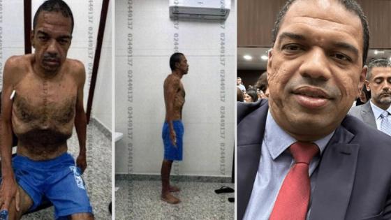 Imagens revelam deterioração física de lobista investigado pelo STJ.