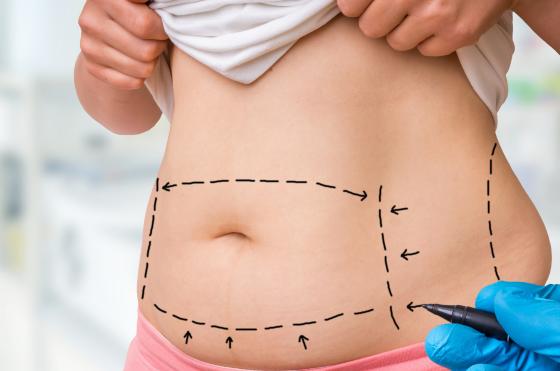 cirurgia plástica